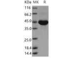 Recombinant Human TSPAN8/Tetraspanin 8 Protein (Fc Tag) - ABMIUM