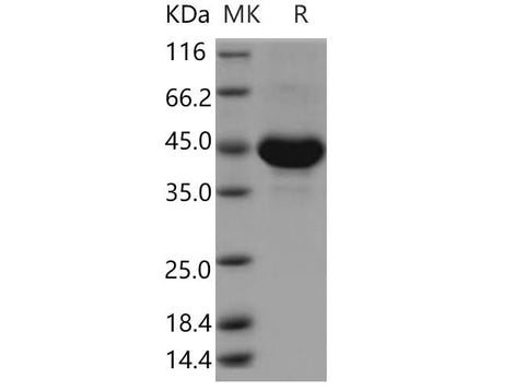Recombinant Human TSPAN8/Tetraspanin 8 Protein (Fc Tag) - ABMIUM