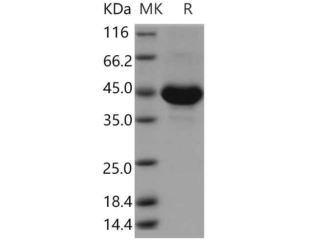 Recombinant Human TSPAN8/Tetraspanin 8 Protein (Fc Tag) - ABMIUM