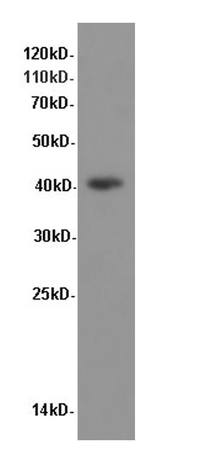 Anti-Human/Mouse P38 Antibody - ABMIUM