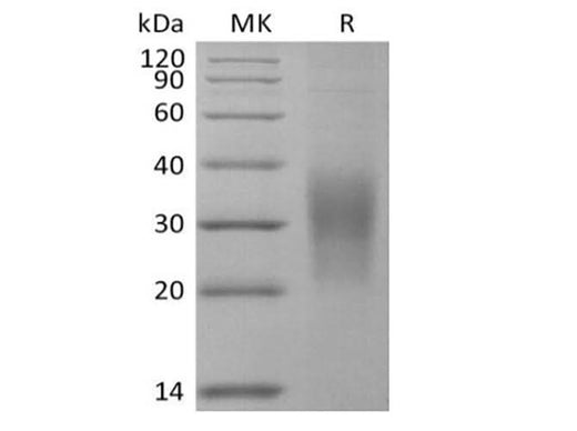 Recombinant Mouse SECTM1A (C-6His) - ABMIUM