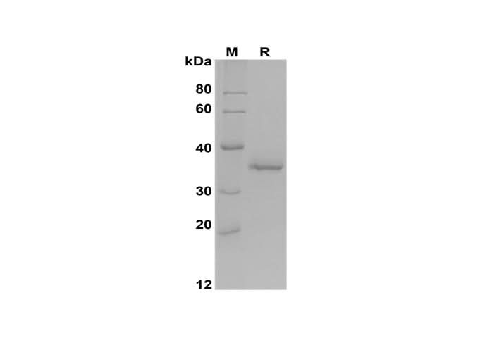 SDS-PAGE analysis of Mouse Acp5 proteins, 2 μg/lane of Recombinant Mouse Acp5 proteins was resolved with SDS-PAGE under reducing conditions, showing bands at 36 kDa.