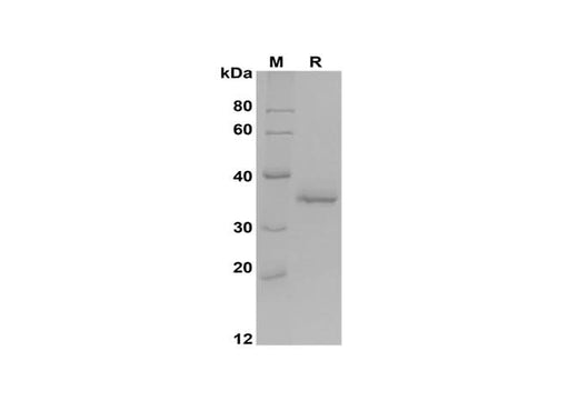 SDS-PAGE analysis of Mouse Acp5 proteins, 2 μg/lane of Recombinant Mouse Acp5 proteins was resolved with SDS-PAGE under reducing conditions, showing bands at 36 kDa.