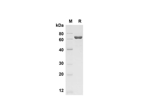 SDS-PAGE analysis of Mouse Chitinase 3-like 1 proteins , 2 μg/lane of Recombinant Mouse Chitinase 3-like 1 proteins was resolved with SDS-PAGE under reducing conditions , showing bands at 70 kDa.