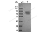 Recombinant Human TEM7/PLXDC1 Protein (His Tag) - ABMIUM