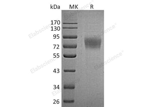 Recombinant Human TEM7/PLXDC1 Protein (His Tag) - ABMIUM