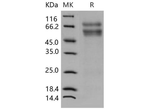 > 95 % as determined by reducing SDS-PAGE.