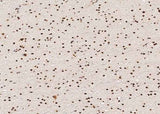 Anti-Human MAPK14 Antibody [A1016] - ABMIUM