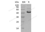 Recombinant Human ADH7 Protein (His Tag) - ABMIUM