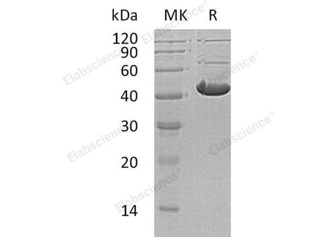 Recombinant Human ADH7 Protein (His Tag) - ABMIUM
