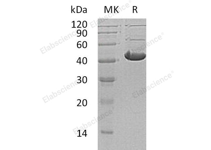 Recombinant Human ADH7 Protein (His Tag) - ABMIUM