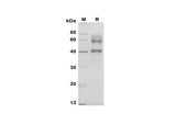 SDS-PAGE analysis of Mouse CD25/IL-2 Rα proteins, 2 μg/lane of Recombinant Mouse CD25/IL-2 Rα proteins was resolved with SDS-PAGE under reducing conditions, showing bands at 55-60 kDa.