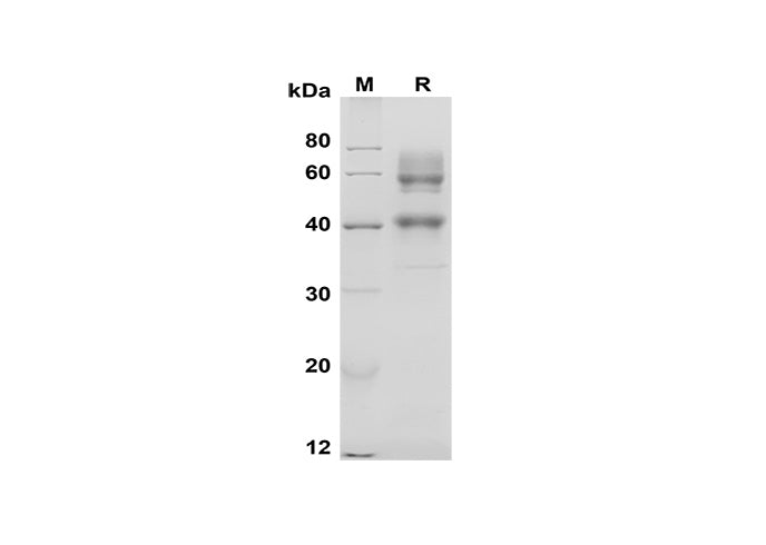 SDS-PAGE analysis of Mouse CD25/IL-2 Rα proteins, 2 μg/lane of Recombinant Mouse CD25/IL-2 Rα proteins was resolved with SDS-PAGE under reducing conditions, showing bands at 55-60 kDa.
