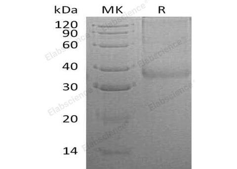 Recombinant Human CHRNB3 Protein (His Tag) - ABMIUM