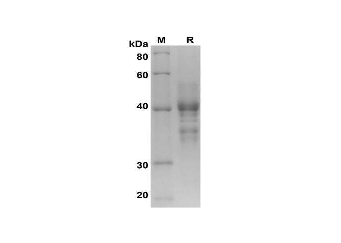SDS-PAGE analysis of Human BAFFR/ TNFRSF13C proteins, 2 μg/lane of Recombinant Human BAFFR/ TNFRSF13C proteins was resolved with SDS-PAGE under reducing conditions, showing bands at 42 kDa.