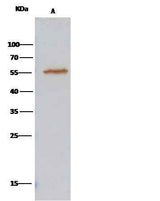 Anti-Human ALDH7A1 Antibody [A1180] - ABMIUM