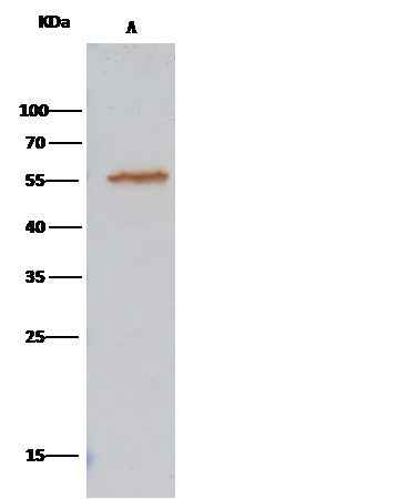 Anti-Human ALDH7A1 Antibody [A1180] - ABMIUM