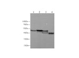 Anti-Human/Mouse/Rat Serpina1 Antibody - ABMIUM