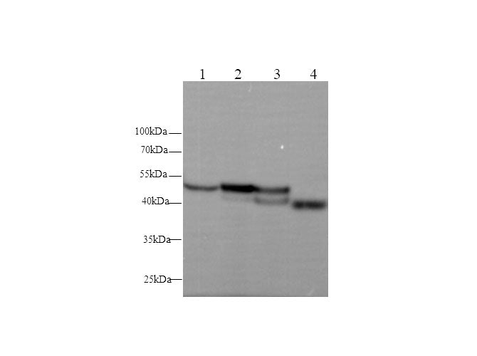 Anti-Human/Mouse/Rat Serpina1 Antibody - ABMIUM