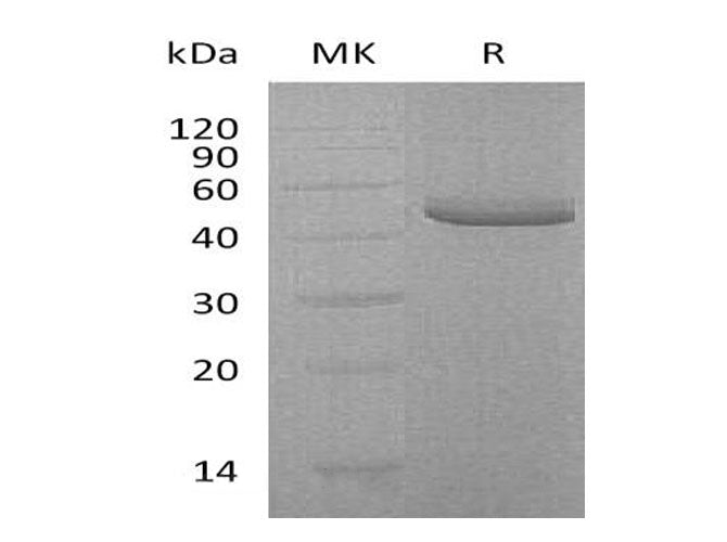 Recombinant Human TRAIL R2/TNFRSF10B Protein (Fc & His Tag) - ABMIUM