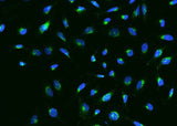 Anti-Human IGFBP7 Antibody [A1173] - ABMIUM