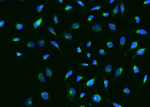 Anti-Human IGFBP7 Antibody [A1173] - ABMIUM