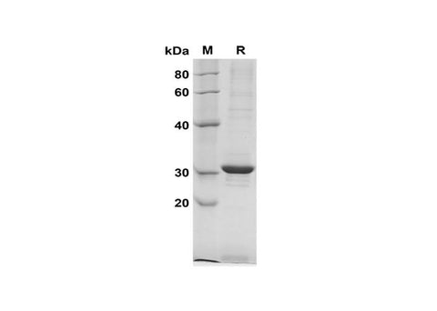 SDS-PAGE analysis of Human DNase-Ⅰ proteins, 2 μg/lane of Recombinant Human DNase-Ⅰ proteins was resolved with SDS-PAGE under reducing conditions, showing bands at 31 kDa.