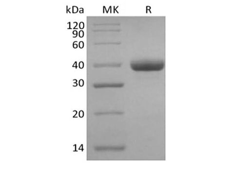Recombinant Human IgG3 Fc - ABMIUM