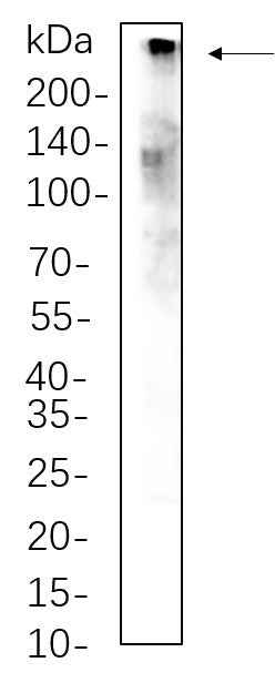 Anti-Human/Mouse/Rat CREBBP Antibody [B1119] - ABMIUM