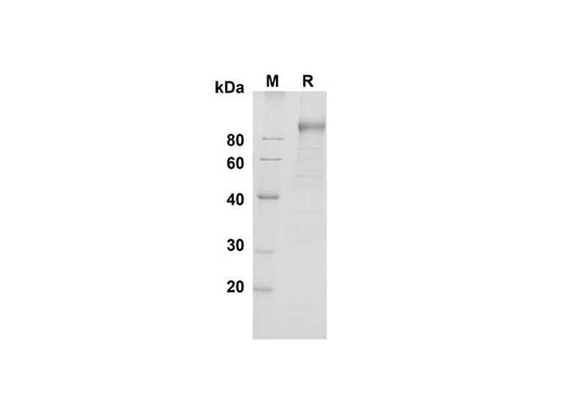 SDS-PAGE analysis of Mouse DPPIV/CD26 proteins , 2 μg/lane of Recombinant Mouse DPPIV/CD26 proteins was resolved with SDS-PAGE under reducing conditions , showing bands at 90 kDa.