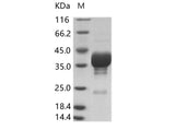Recombinant Cox A16 (strain G-10) VP4 Protein (Fc Tag) - ABMIUM