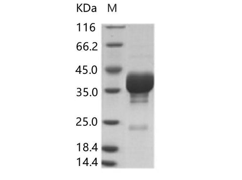 Recombinant Cox A16 (strain G-10) VP4 Protein (Fc Tag) - ABMIUM