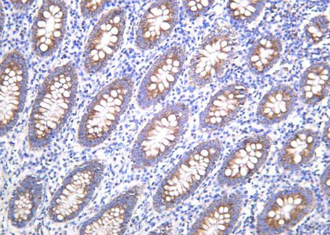 Anti-Human BMP-4 Antibody [B1045] - ABMIUM