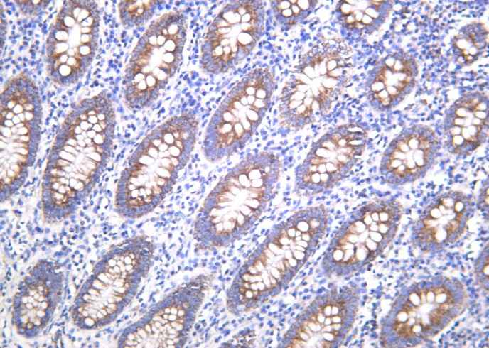 Anti-Human BMP-4 Antibody [B1045]