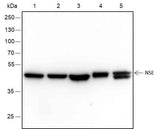 Anti-Human/Rat/Mouse NSE Antibody [A314]