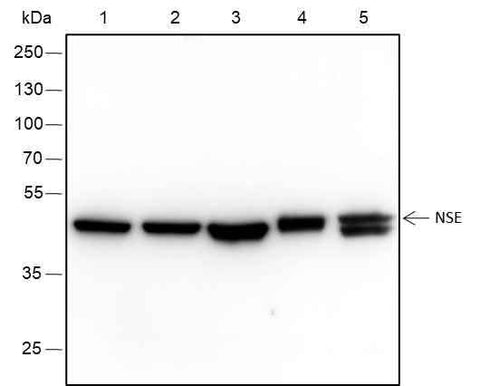 Anti-Human/Rat/Mouse NSE Antibody [A314] - ABMIUM