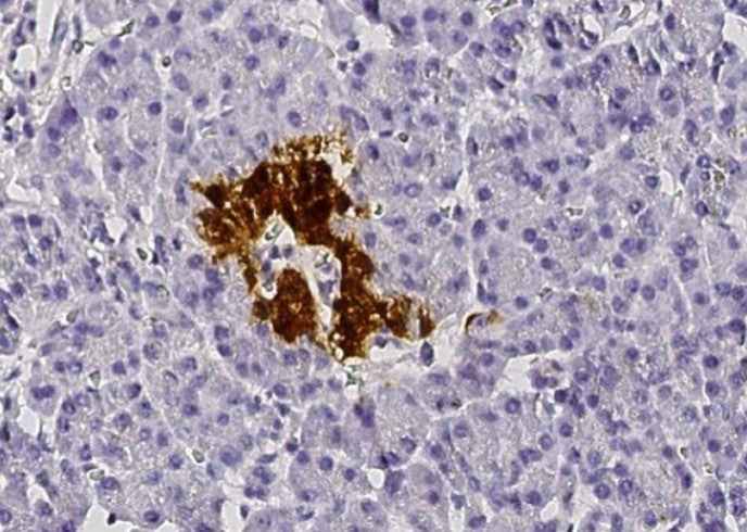 Anti-Human SCGN Antibody [A978] - ABMIUM