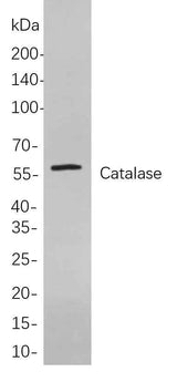 Anti-Human/Mouse/Rat Catalase Antibody [B840]