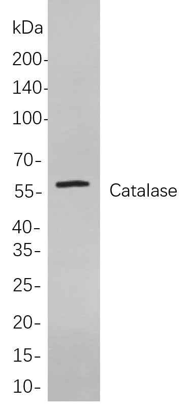 Anti-Human/Mouse/Rat Catalase Antibody [B840] - ABMIUM