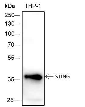 Anti-Human STING Antibody [A369] - ABMIUM