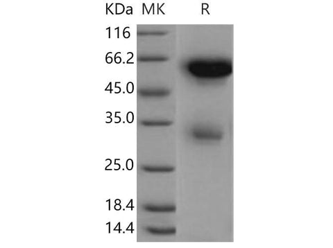 > 75 % as determined by reducing SDS-PAGE.