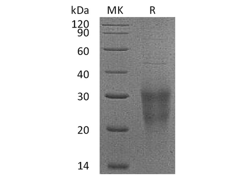 Recombinant Human NKG2D/CD314 Protein (His Tag) - ABMIUM