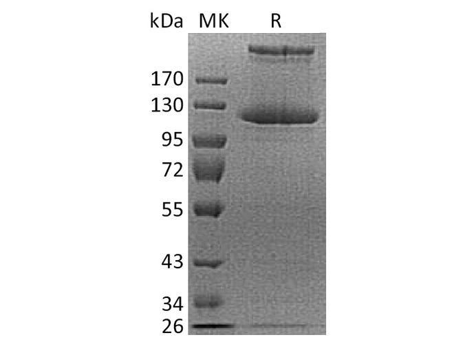 Recombinant Human COL21A1 Protein (His Tag) - ABMIUM