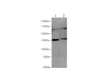 Anti-Mouse/Rat L1CAM Antibody - ABMIUM