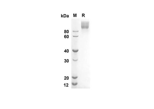 SDS-PAGE analysis of Human KIT/SCFR proteins, 2 μg/lane of Recombinant Human KIT/SCFR proteins was resolved with an SDS-PAGE under reducing conditions, showing bands at 79.8 kDa.