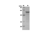 SDS-PAGE analysis of Human ITGAX proteins, 2 μg/lane of Recombinant Human ITGAX proteins was resolved with SDS-PAGE under reducing conditions, showing bands at 50 kDa.