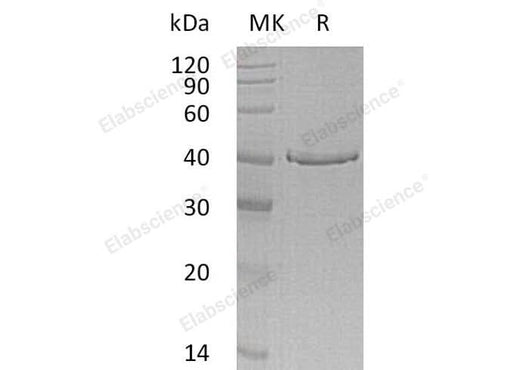 > 85 % as determined by reducing SDS-PAGE.
