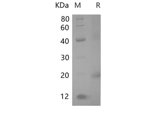 SDS-PAGE analysis of Rat Alpha-fetoprotein proteins, 2 μg/lane of Recombinant Rat Alpha-fetoprotein proteins was resolved with SDS-PAGE under reducing conditions, showing bands at 23.18 kDa.
