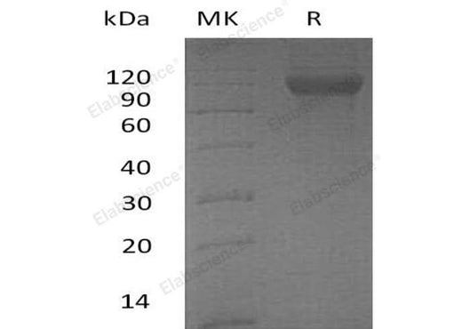Recombinant Human DCBLD2/ESDN Protein (aa 67-528, His Tag) - ABMIUM