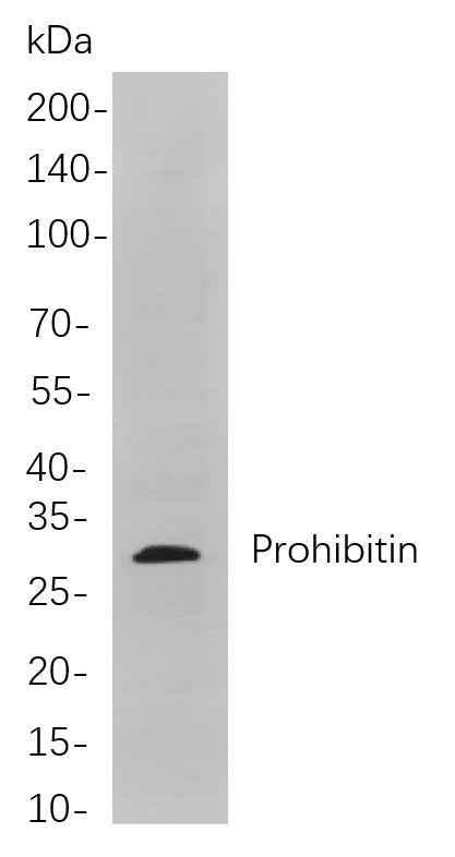 Anti-Human/Mouse/Rat Prohibitin Antibody [B805] - ABMIUM